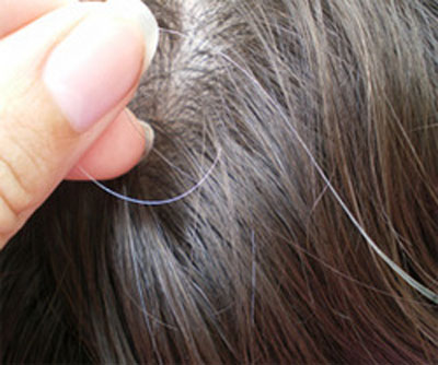 grey hair and hair loss 250x250