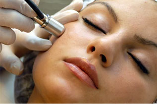 Microdermabrasion ،میکرودرم ابریژن