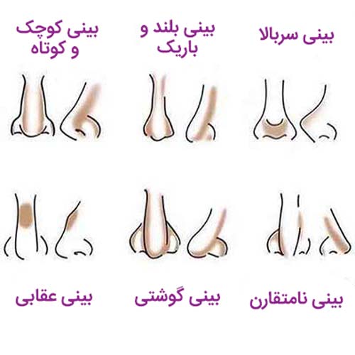 فیلم گریم بینی -آرایش بینی گوشتی -گریم انواع بینی- گریم بینی پهن -گریم بینی قوز دار -گریم بینی دراز -گریم بینی گوشتی -کانتورینگ بینی گوشتی