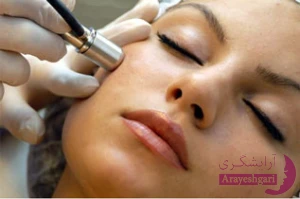 Microdermabrasion ،میکرودرم ابریژن